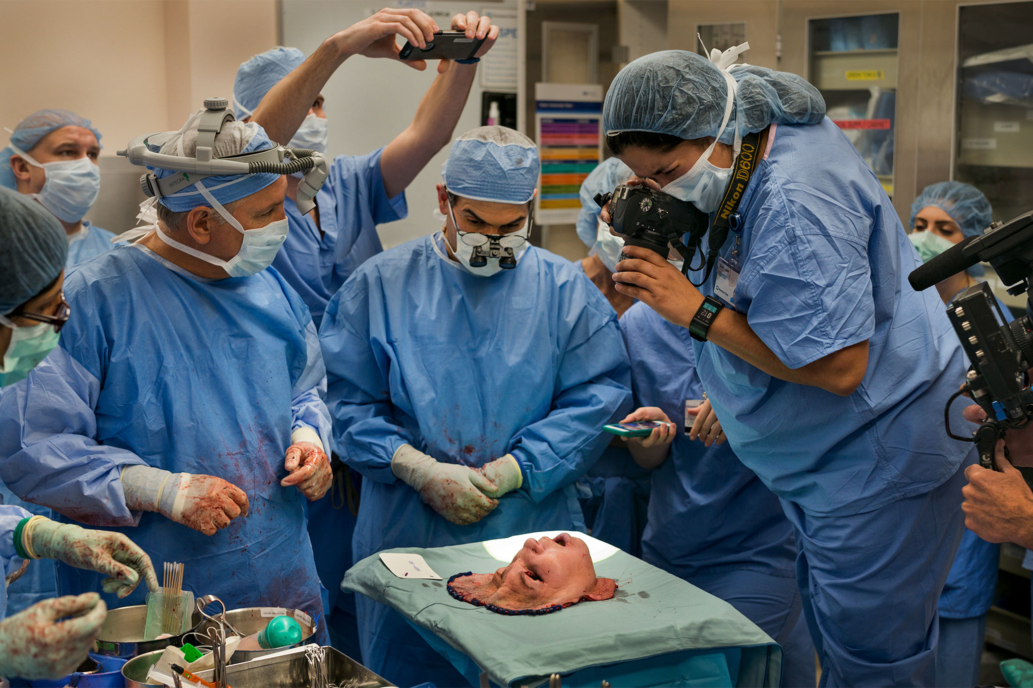 Picture of a group of surgeons examining a face for a face transplant