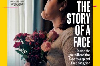 The Story of a Face: National Geographic Unveils Youngest Full-Face Transplant Recipient in American History